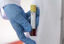 Українських вчених, які розробили тести на COVID-19, відправили у неоплачувану відпустку