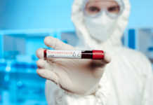 Коронавірус в Україні: вітчизняні ПЛР-тести направили в регіони