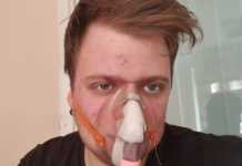 “Підйом о 6:00, крапельниці та токсичні ліки”: історія 21-річного українця, який бореться з кopoнавірусом