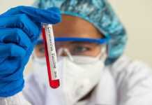 Коронавірус не надто шкідливий, смертність може бути завищена. Інтерв’ю з американським вірусологом, який працює над вакцинами