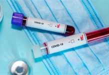 В Україні в п’яти областях не зафіксували нові випадки зараження на COVID-19