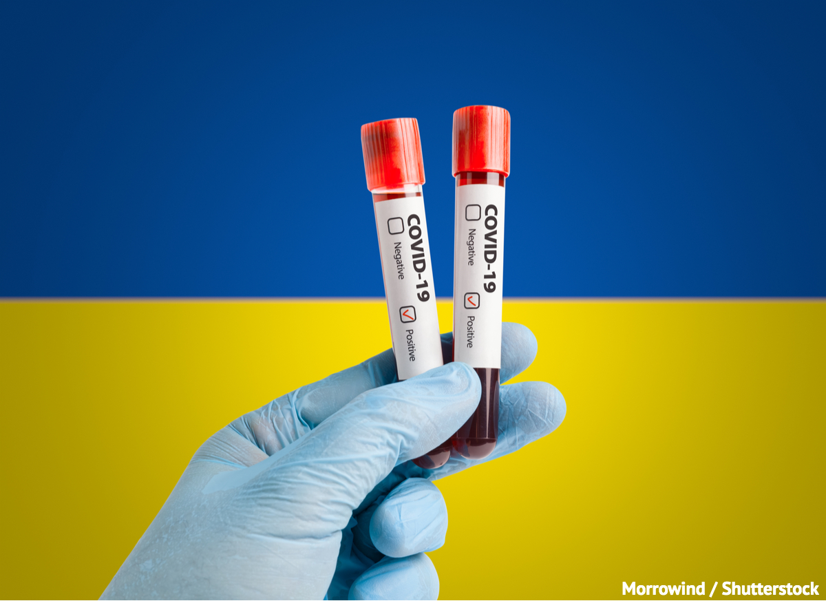 ПЛР-тести на коронавірус можуть дати помилковий результат, - Максим Степанов