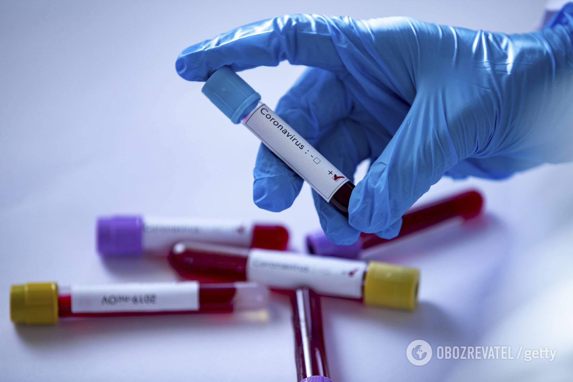 Вакцина від коронавірусу може з'явитися на початку 2021 року