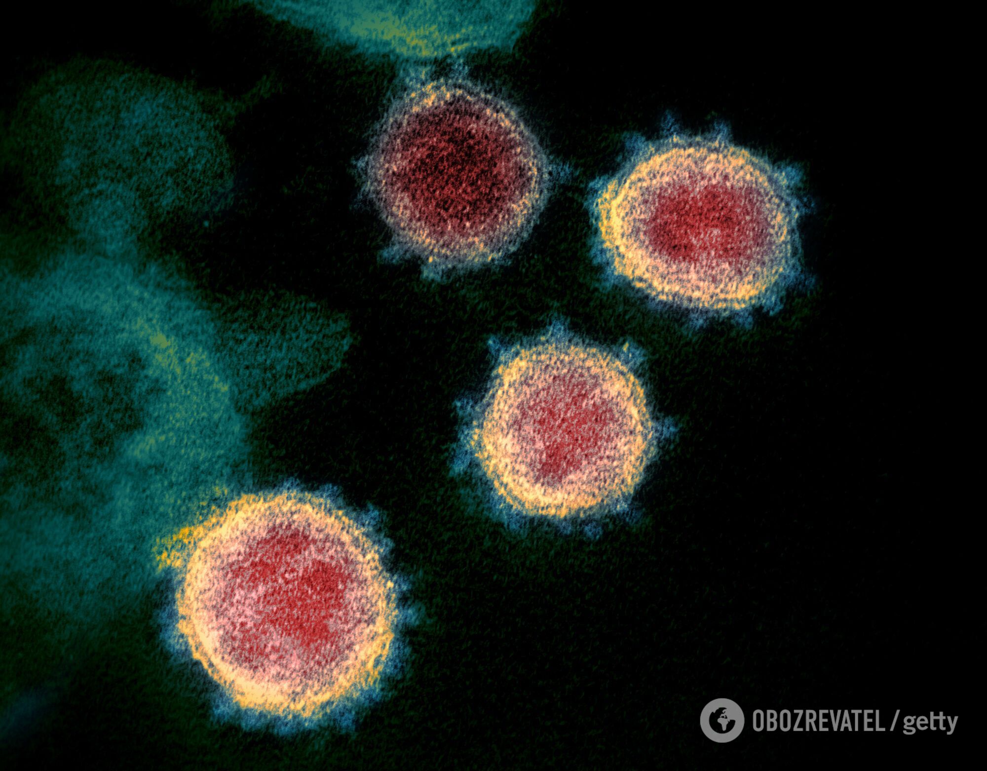 Восени сезонний грип буде конкурувати з коронавірусом