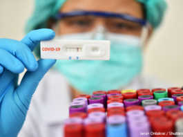 Коронавірус провокує захворювання, які можуть з’явитися через 5-10 років, – лікар